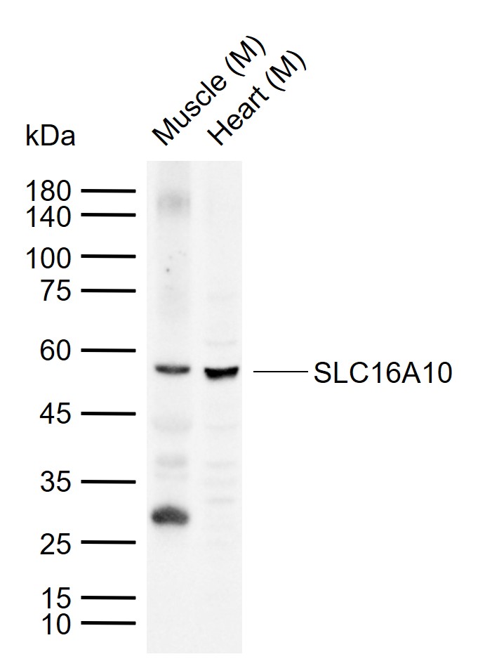 SLC16A10 Rabbit pAb(bs-19797R)