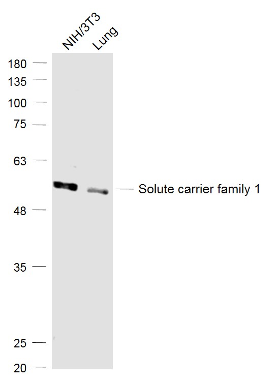 SLC1A5 Rabbit pAb(bs-21518R)-5