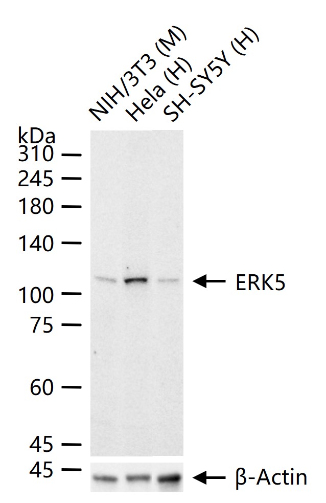 ERK5 Recombinant Rabbit mAb(bs