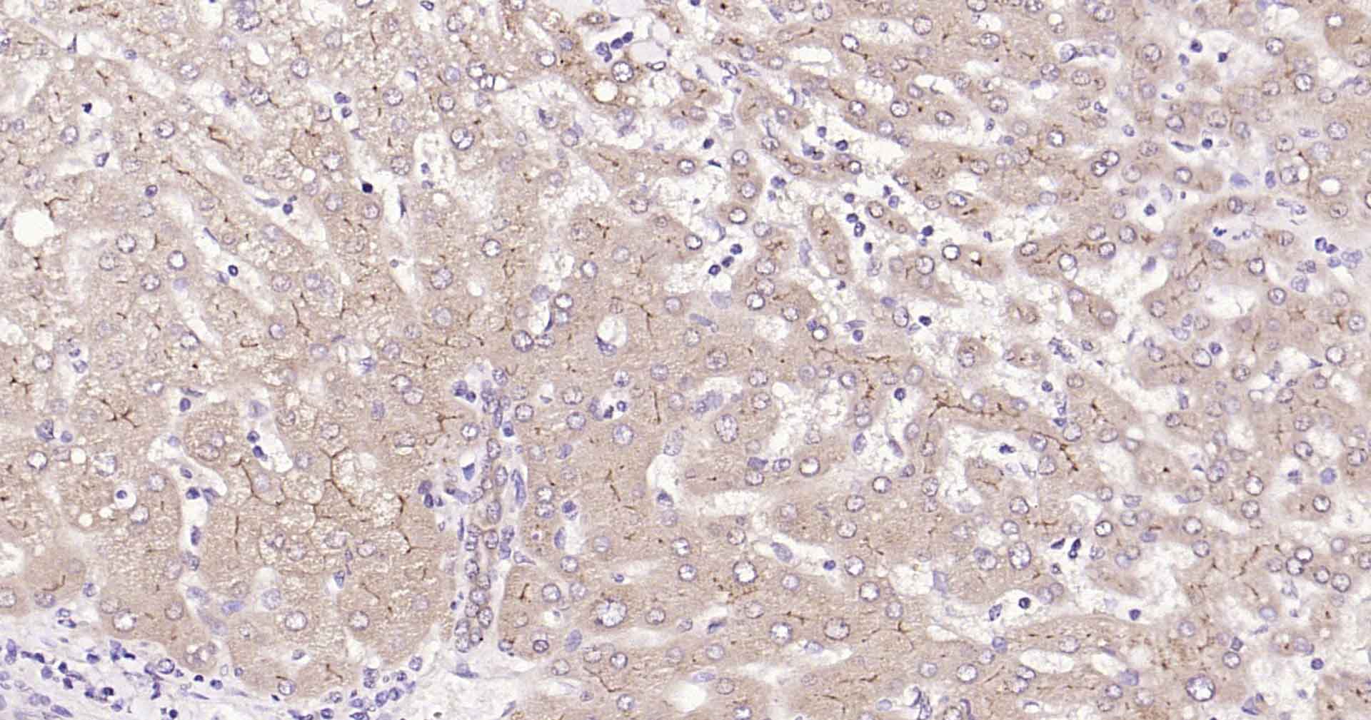 MRP2/ABCC2 Rabbit pAb(bs-1092R