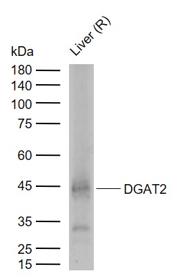 DGAT2 Rabbit pAb(bs-22551R)-50