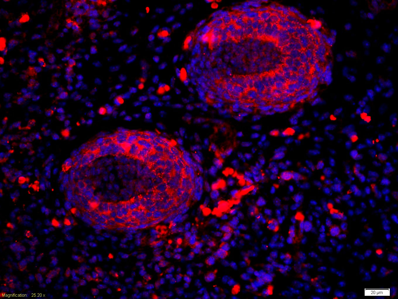 ALDH1A2 Rabbit pAb(bs-3676R)-5