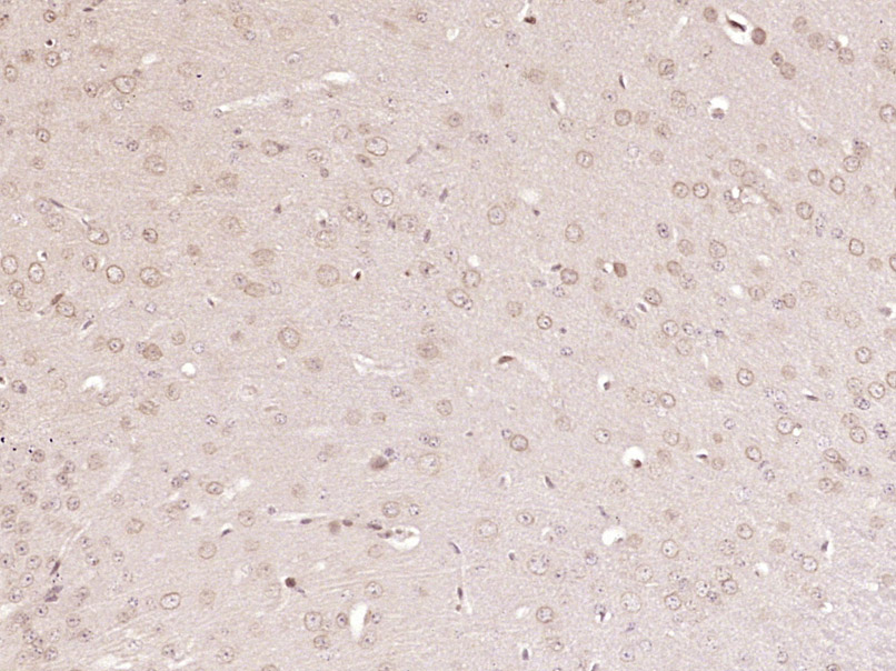 PIK3CA Rabbit pAb(bs-2067R)-50