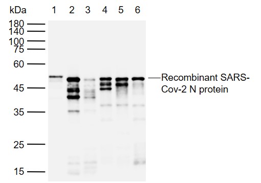 SARS-CoV-2 (2019-nCoV) Nucleoc