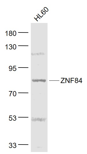 ZNF84 Rabbit pAb(bs-4471R)-50u