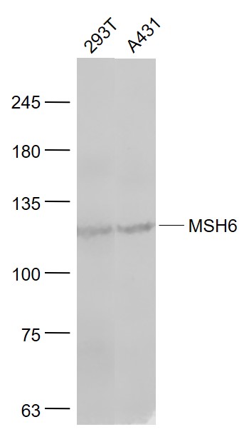 MSH6 Rabbit pAb(bs-3804R)-50ul