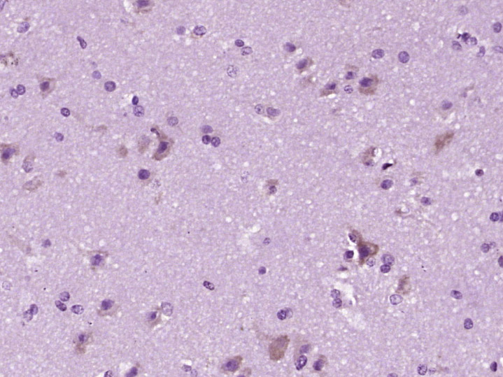 C1QA Rabbit pAb(bs-11336R)-50u