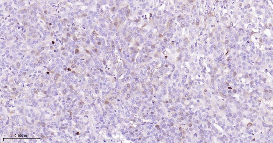 TYMS Recombinant Rabbit mAb(bs