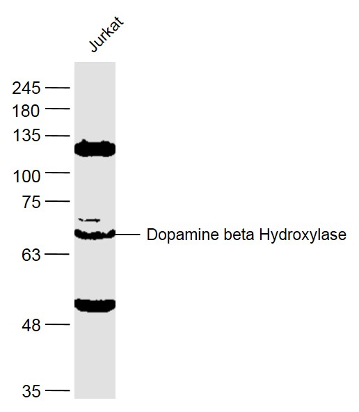 Dopamine beta Hydroxylase Rabb
