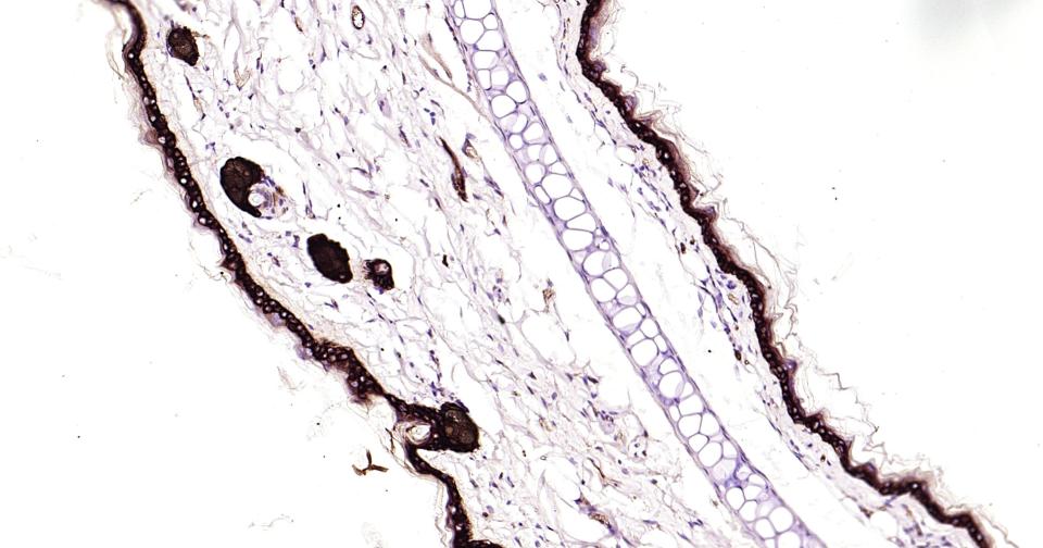 Cytokeratin 14 Recombinant Rab