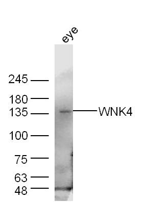 WNK4 Rabbit pAb(bs-0429R)-50ul