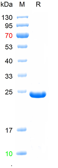 Recombinant human RBP4 protein