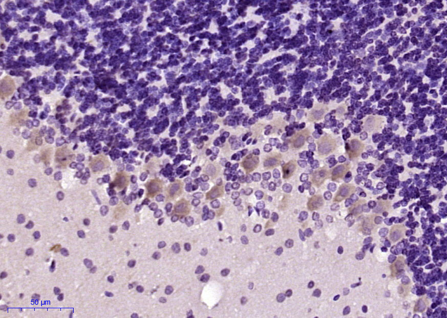 CBLN2 Rabbit pAb(bs-11815R)-50