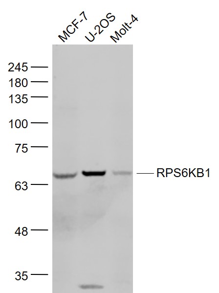 RPS6KB1 Rabbit pAb(bs-6370R)-5