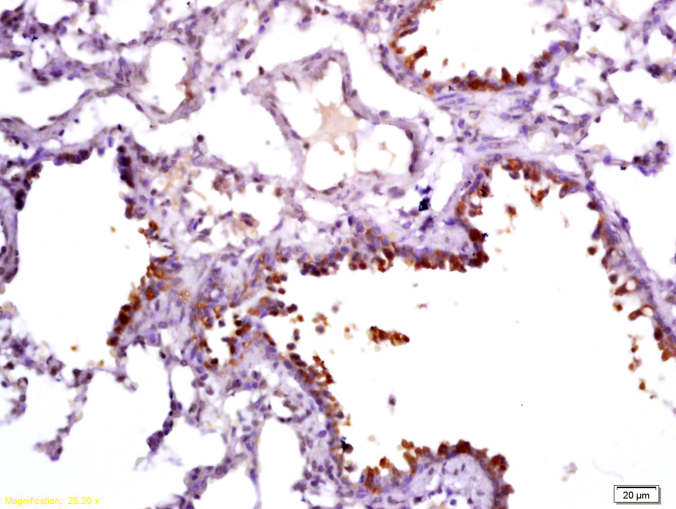 Uteroglobin Rabbit pAb(bs-1487