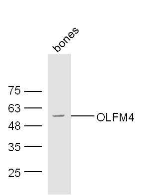 OLFM4 Rabbit pAb(bs-6558R)-50u