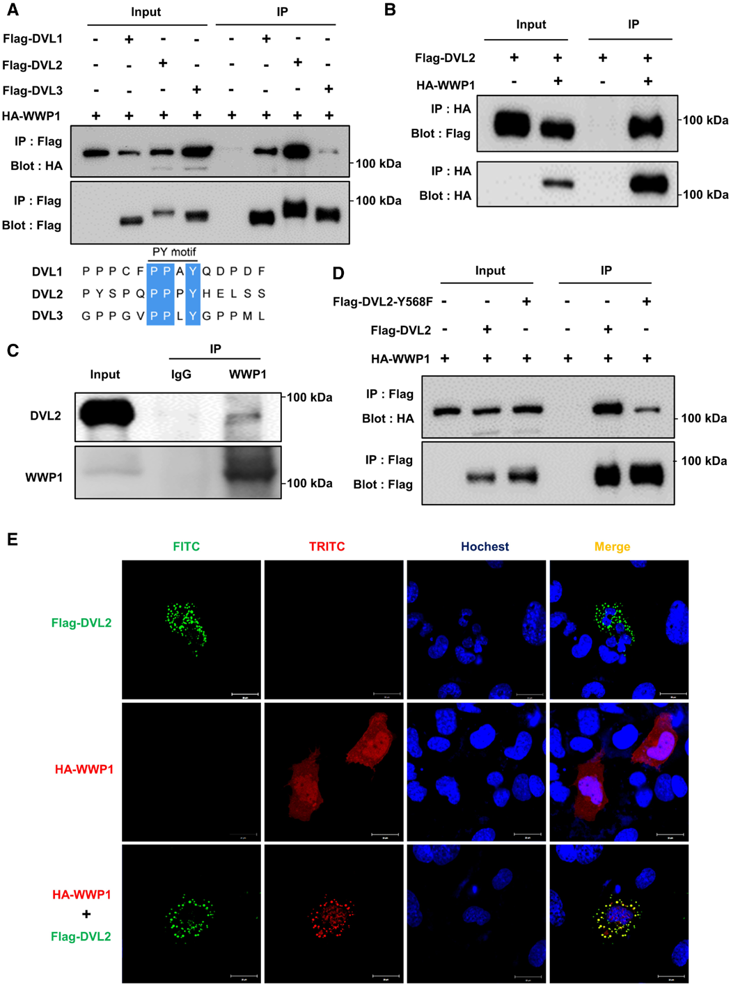 IF=23.603【AAV在心脏疾病中的应用】科学家揭示病理性心肌肥厚及心力衰竭治疗的潜在靶点