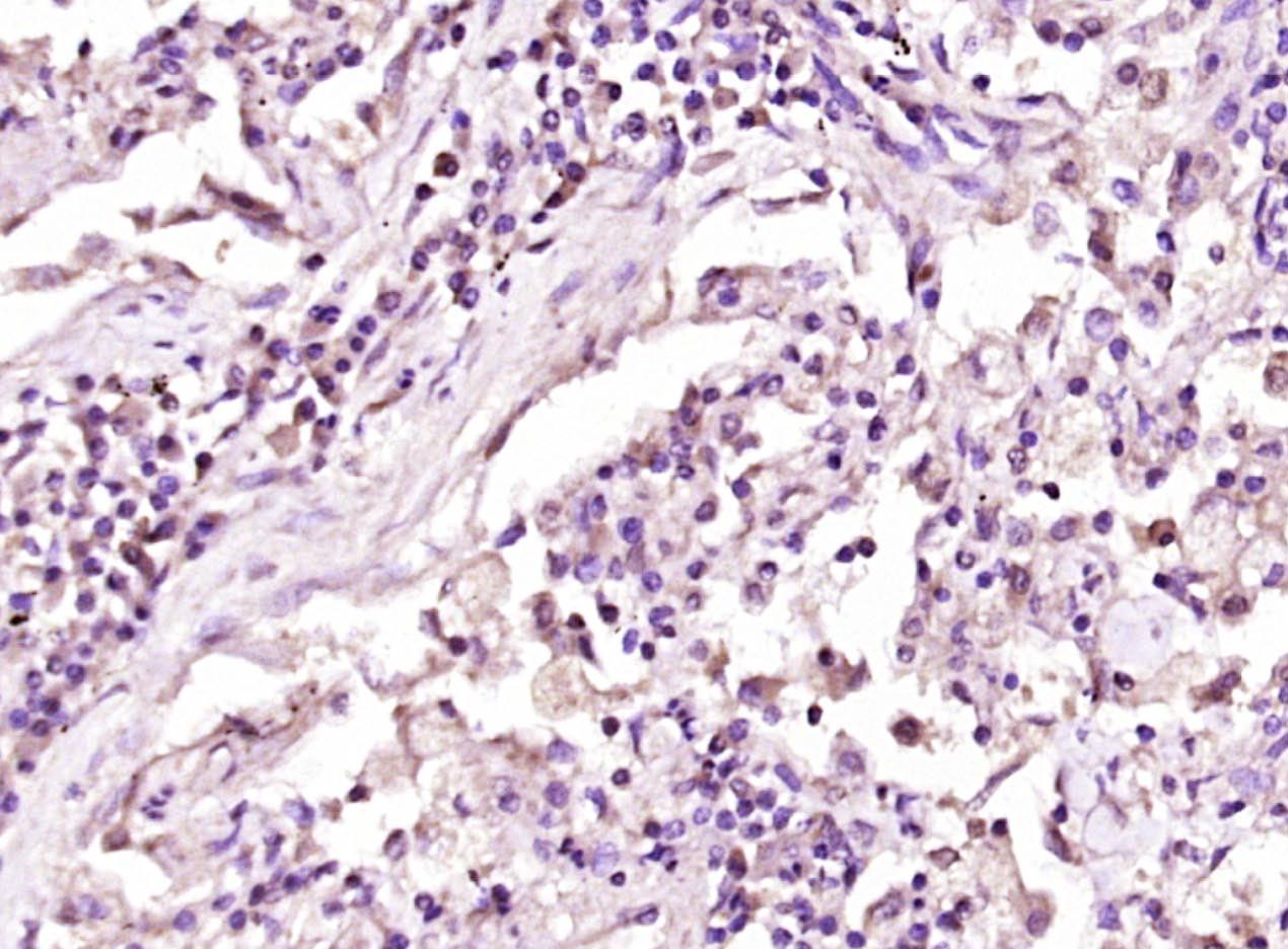 phospho-Dishevelled 2 (Thr224)