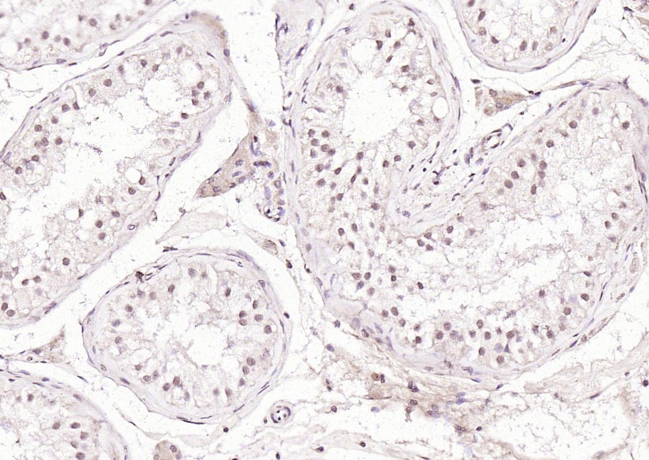 PLK1 Rabbit pAb(bs-3535R)-50ul