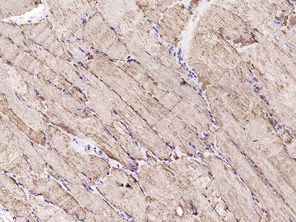 VDAC1 Recombinant Rabbit mAb, 