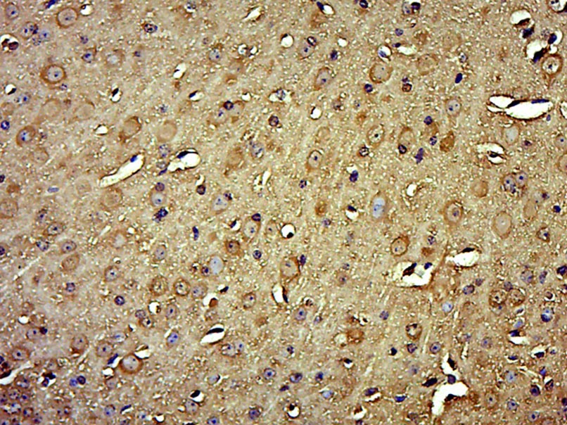 HYLS1 Rabbit pAb(bs-18114R)-50