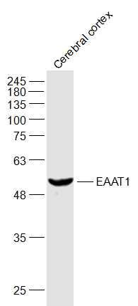 EAAT1 Rabbit pAb(bs-23309R)-50