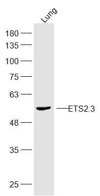 ETS2.3 Rabbit pAb(bs-14641R)-5