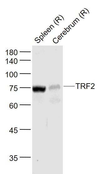TRF2 Rabbit pAb(bs-22936R)-50u