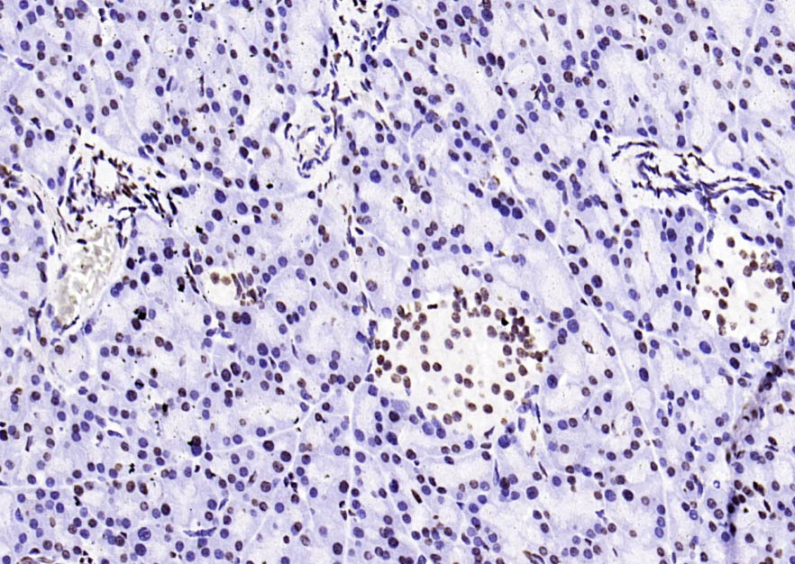 Histone H3(di methyl K27) Mous