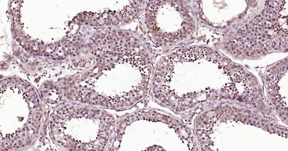 RAB5B Rabbit pAb(bs-11783R)-50