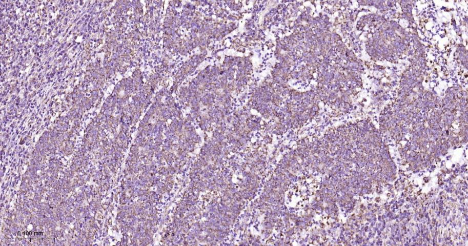 VDAC1 Recombinant Rabbit mAb, 