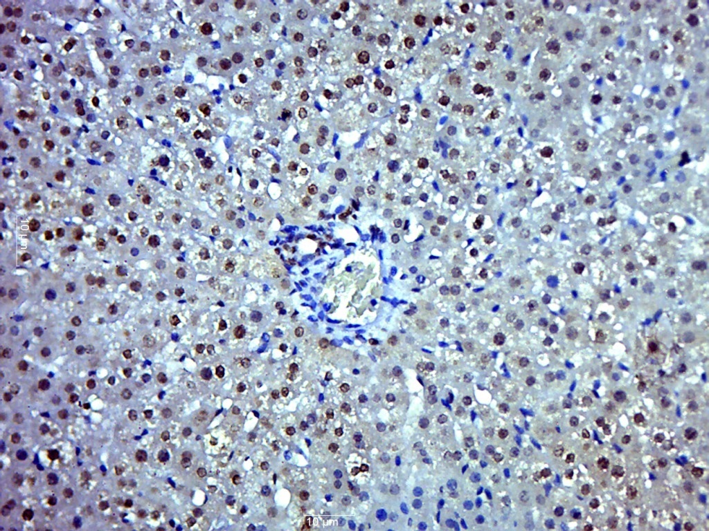 Cyclin D1 Rabbit pAb(bs-20596R