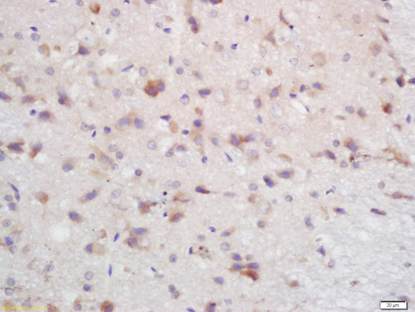 MARK2 Rabbit pAb(bs-5741R)-50u