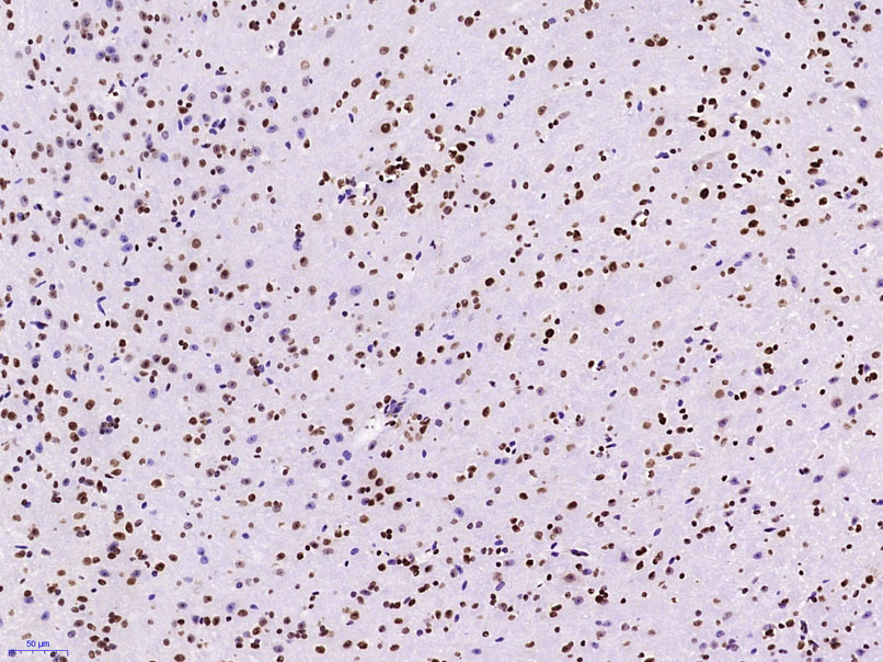 KLHL7 Rabbit pAb(bs-5935R)-50u