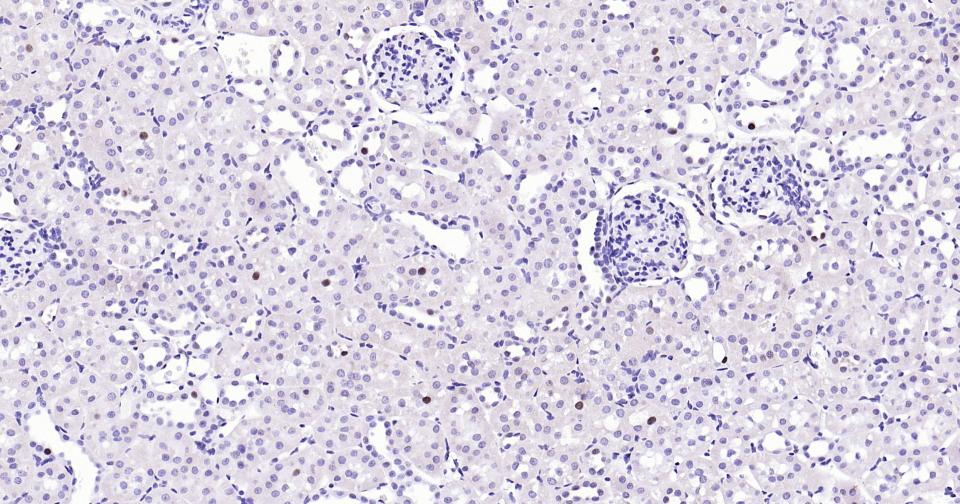 PCNA Rabbit pAb(bs-10889R)-50u