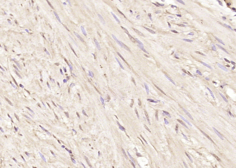 JMJD5 Rabbit pAb(bs-8047R)-50u