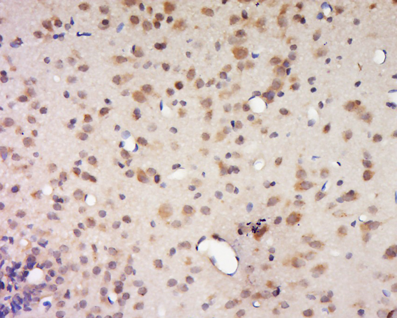 DALRD3 Rabbit pAb(bs-14192R)-5