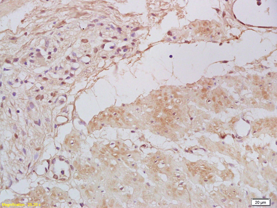 Tbx21 Rabbit pAb(bs-3599R)-50u