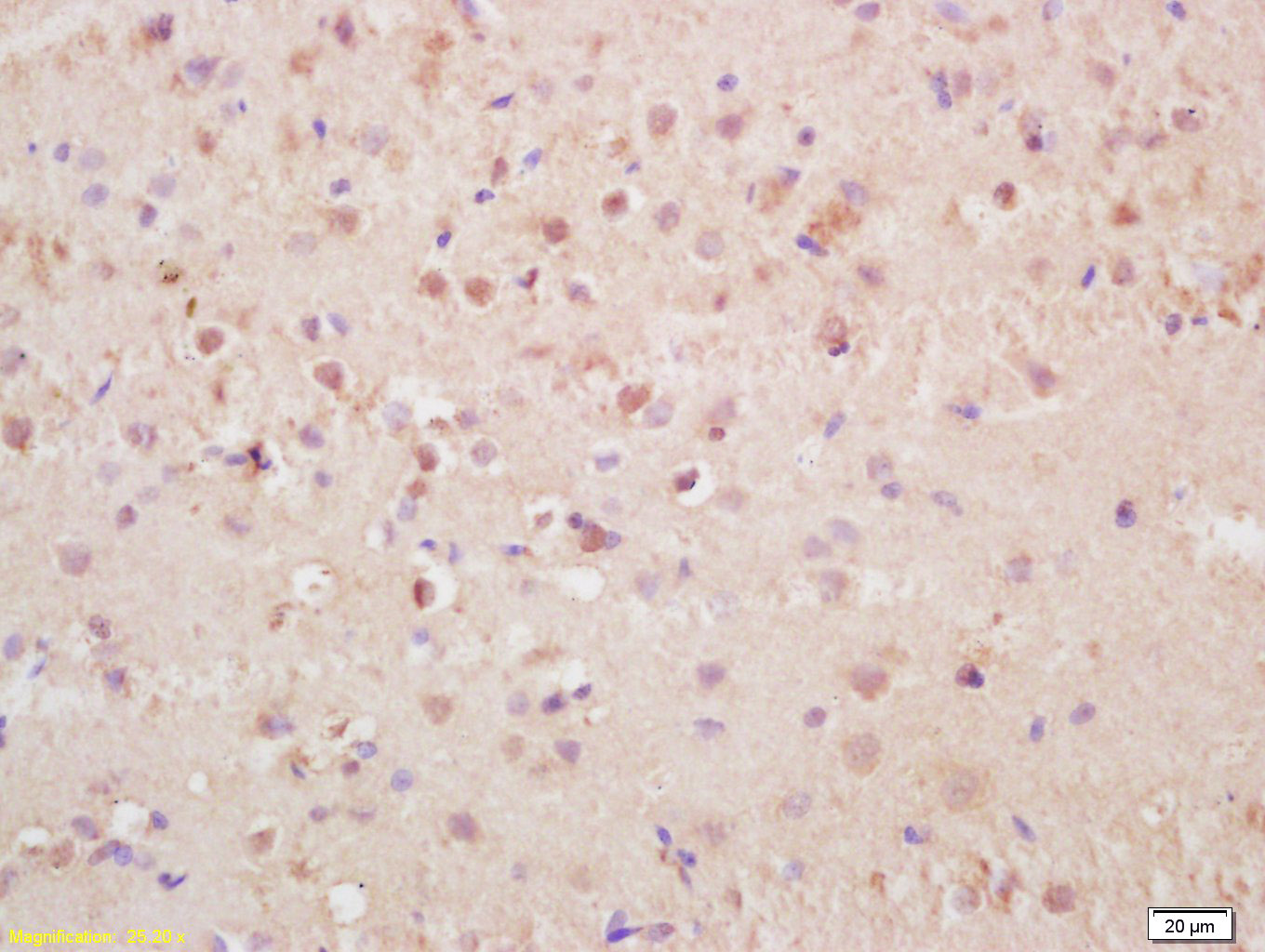 phospho-Histone H3 (Thr3) Rabb