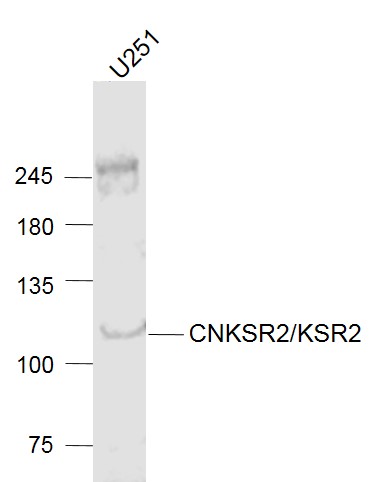 CNKSR2/KSR2 Rabbit pAb(bs-8029