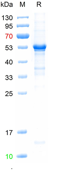 Recombinant human P53 protein,