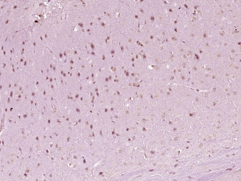 HOXA6 Rabbit pAb(bs-11294R)-50