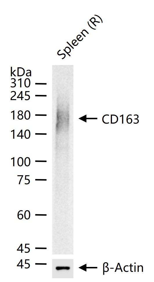 CD163 Rabbit pAb(bs-2527R)-50u