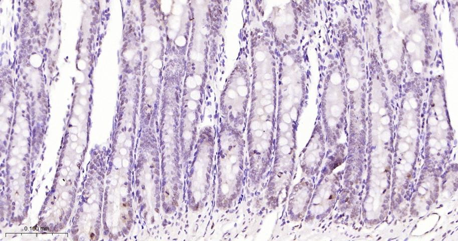 phospho-STAT3 (Tyr705) Mouse m