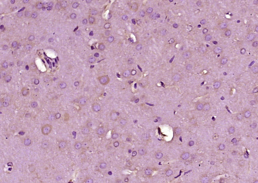 CaMKK1 Rabbit pAb(bs-11247R)-5