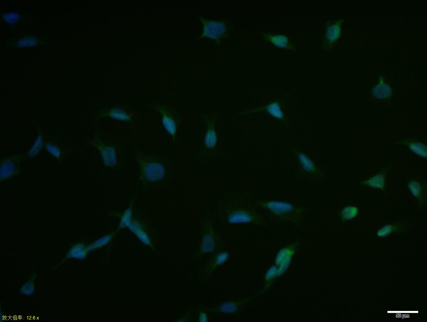 HNF1A Rabbit pAb(bs-1405R)-50u