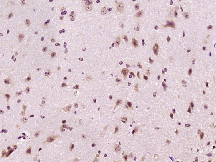 MVD Rabbit pAb(bs-5085R)-50ul/