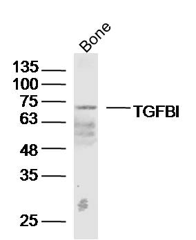TGFBI Rabbit pAb(bs-7443R)-50u