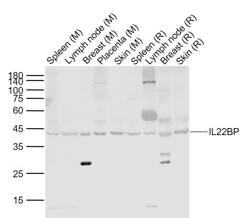 IL22BP Rabbit pAb(bs-2625R)-50