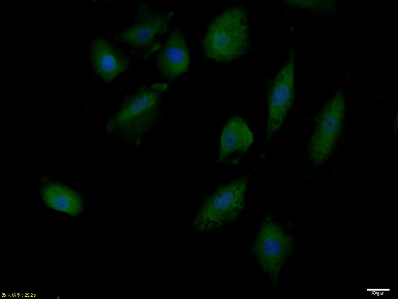phospho-IRS1 (Tyr632) Rabbit p